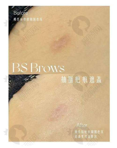 四、武汉正璞瘢痕整复医疗美容门诊部基本信息：