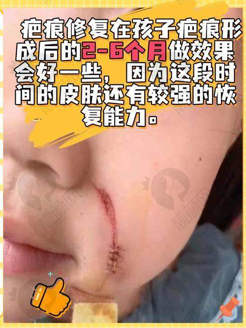 一、武汉正璞瘢痕整复医疗美容门诊部怎么样？