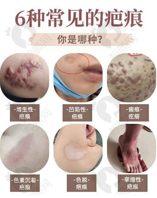 七、武汉正璞瘢痕整复医疗美容门诊部真实的患者评价如下：