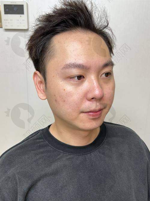 佛山曙光金子整形医院优点总结
