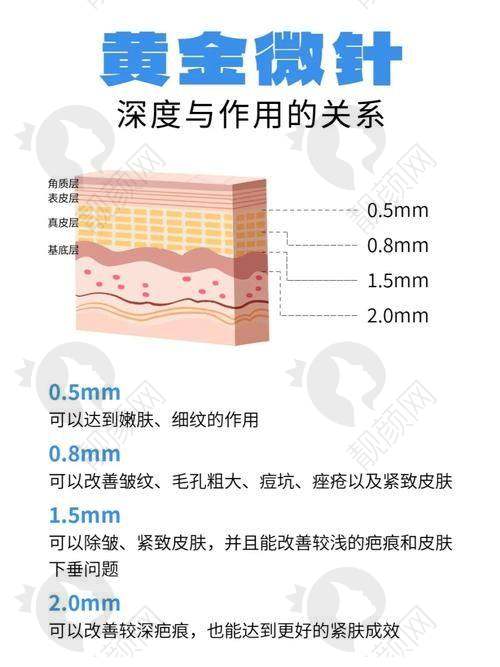 佛山曙光金子整形黄金微针项目优势