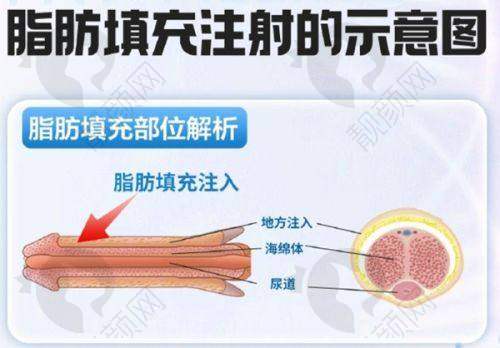 一、广州米伦医疗美容门诊部怎么样？