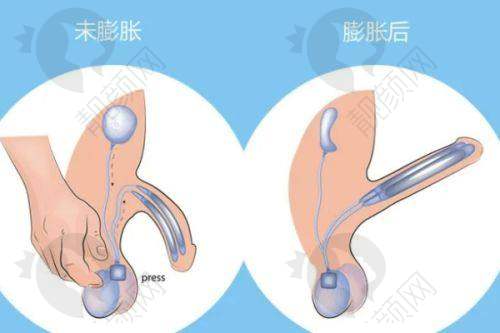 一、东莞东城紫芯医疗美容门诊部怎么样？