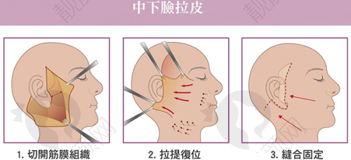 五、常德曹家整形医疗美容医院怎么预约：