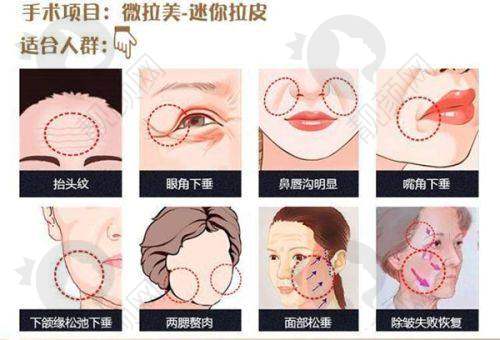 五、广州米伦医疗美容门诊部怎么预约：