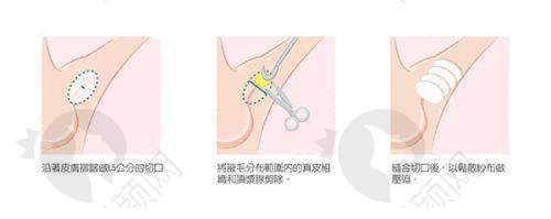 一、深圳美莱医疗美容医院怎么样？