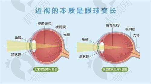 杭州未来科技城医院眼科医生实力展示