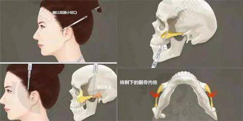 三、广州米伦医疗美容门诊部医生介绍: