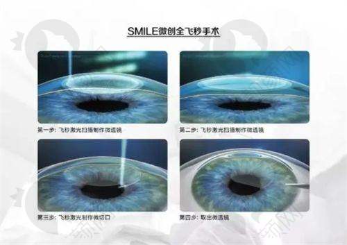 云南大学附属医院眼科:地址、乘车路线与预约方式