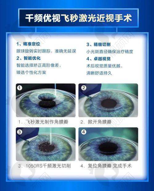 兰州普瑞眼科医院超声乳化白内障价格之技术特点