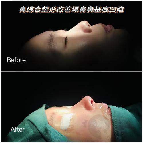 广州韩妃刘志刚医生的真实的患者评价如下