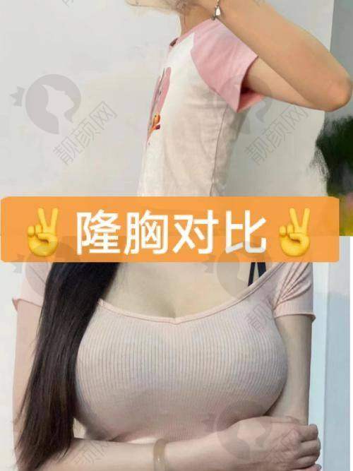 广州韩妃刘志刚医生简介