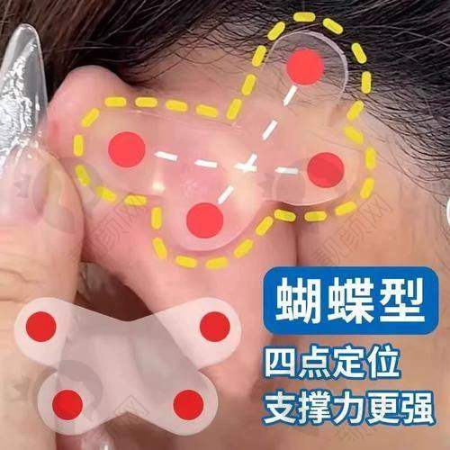 武汉正璞招风耳修复相关医生介绍