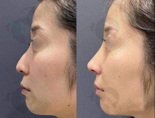 上海华美李健怎么样？