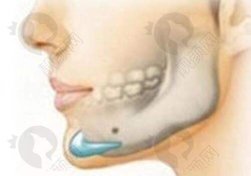 一、北京樱桃医疗美容诊所怎么样？