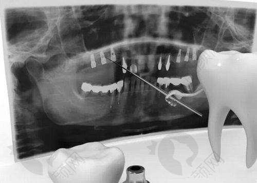 奉送上海曙康透明收费体系