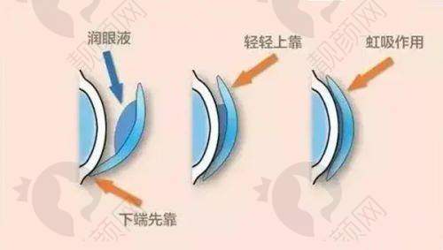 兰州普瑞眼科医院的热门医生团队