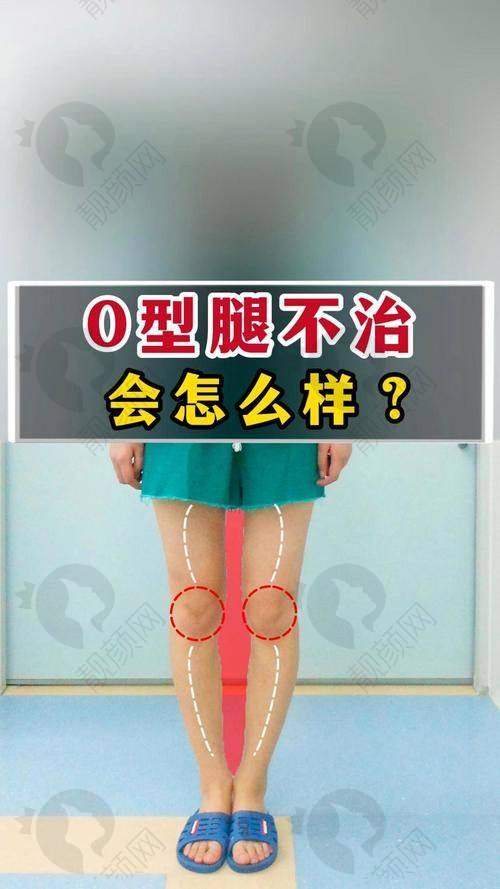 西安西美医院直腿术：收费多少？