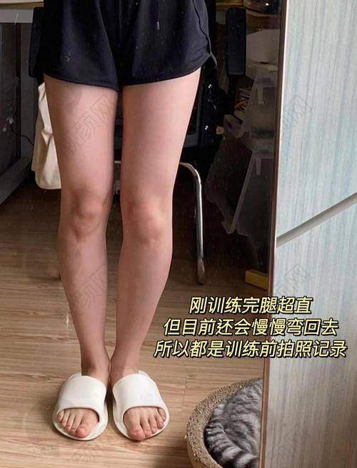 西安西美医院直腿术：医生推荐