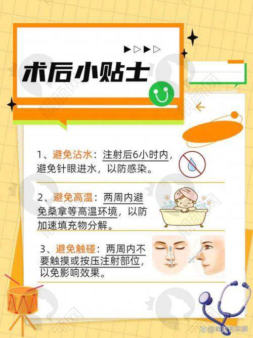 菲林普利隆鼻价格大揭秘：不同型号价格有差异