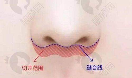 深圳福雅整形：价格合理性价比高