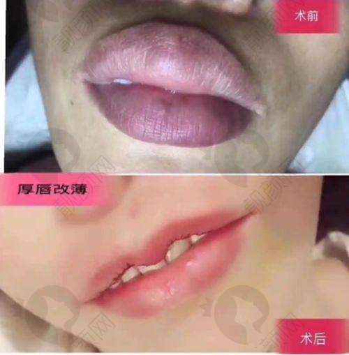 二、上海百汇医疗美容医院正规吗？来看看医院资质：