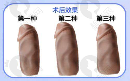 六、广州研媄荟医疗美容门诊部价格表：（仅供参考）