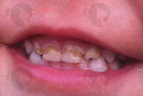 万宁看牙好的医院排名揭晓！臻好口腔——品牌连锁服务优