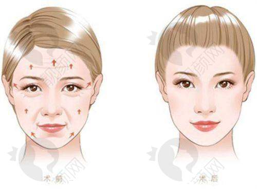 五、上海百汇医疗美容医院开展的主要项目和特色项目：