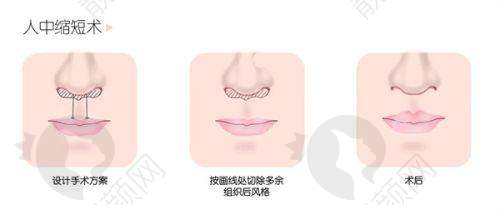 深圳福雅胡俊杰医生简介