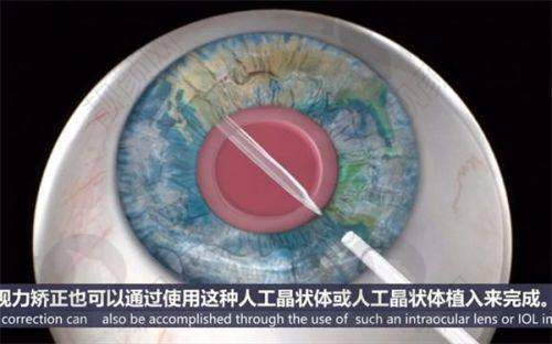 郑州华厦视光眼科医院：贴心服务等你来