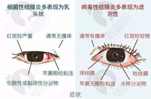 七、赣南医学校第一附属医院眼科真实的患者评价如下：