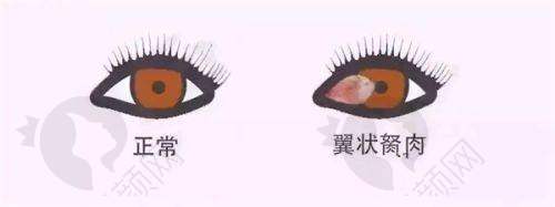 郑州视光眼科华厦半飞秒激光:个性化方案的贴心服务
