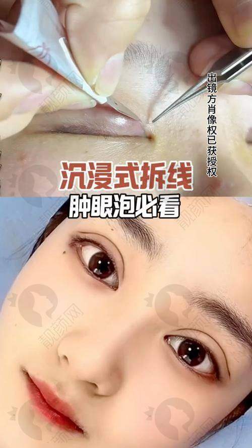 潘贰医生简介