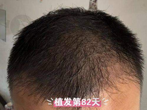 二、珠海九龙医院植发科正规吗？来看看医院资质：