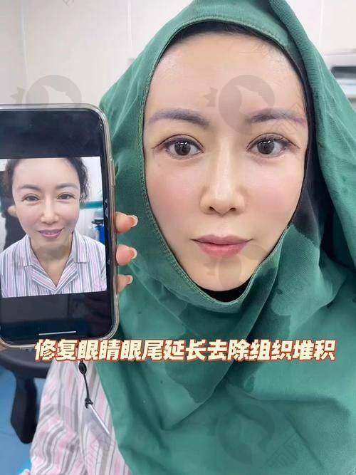 2025修复双眼皮的十大医生之张冰洁：北京克莱美舍张冰洁整形医院的独特魅力