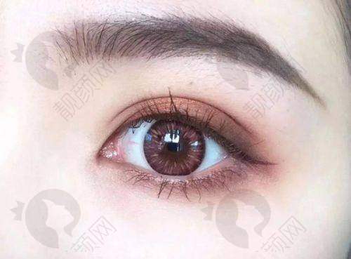 【刘志刚眼整形个人资料】：擅长领域与荣誉加持