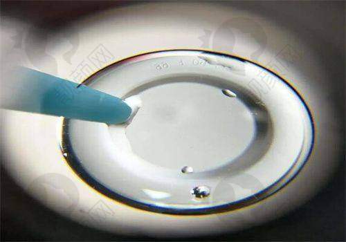 角膜塑形镜适龄佩戴：提升孩子生活质量和学习效率
