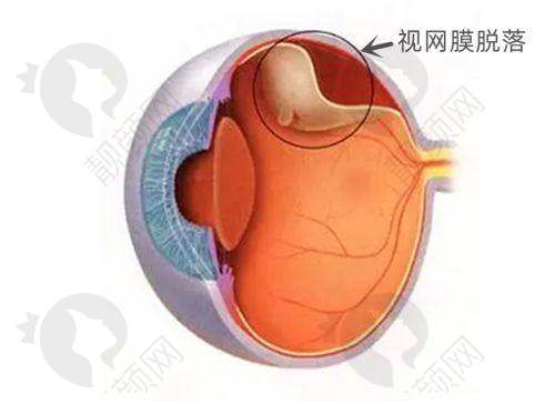 六、龙游爱尔眼科医院真实的患者评价如下：