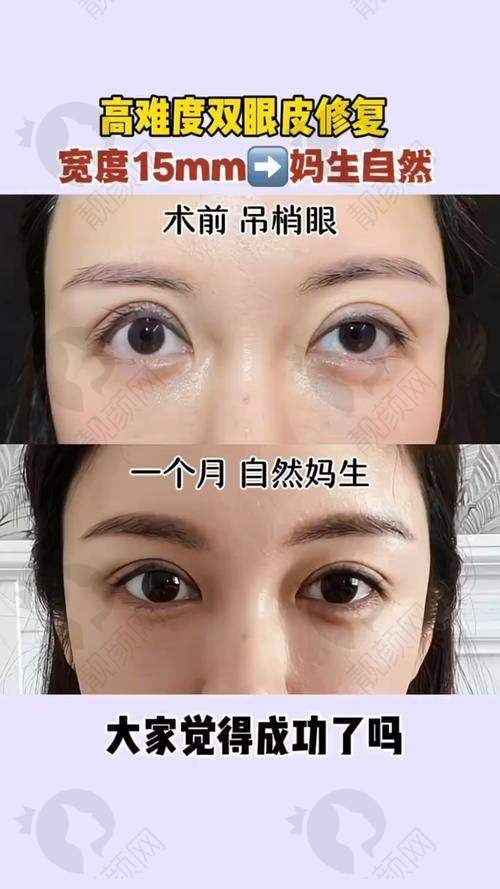 成都中医 大银海整形白振华医生个人资质