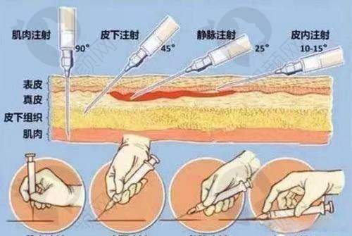 上海华美赵伟医生的真实患者评价如下