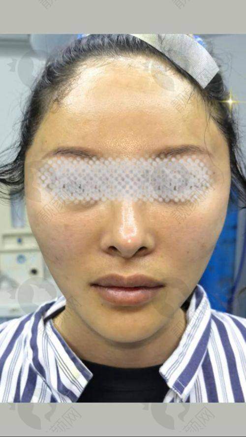 上海华美田波医生的真实的患者评价如下：
