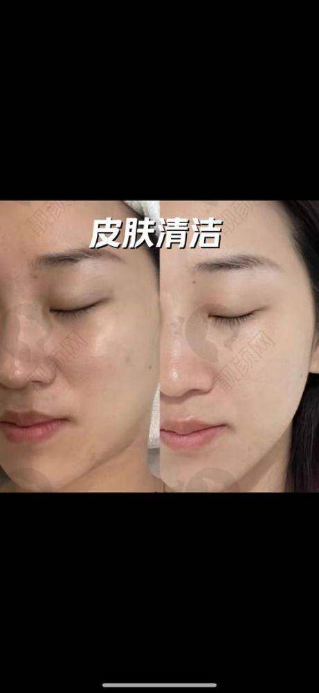 七、西安晶肤皮肤美容医院真实的患者评价如下：