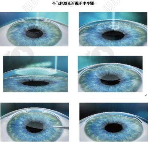 昆明康特森眼科医院医生实力强劲