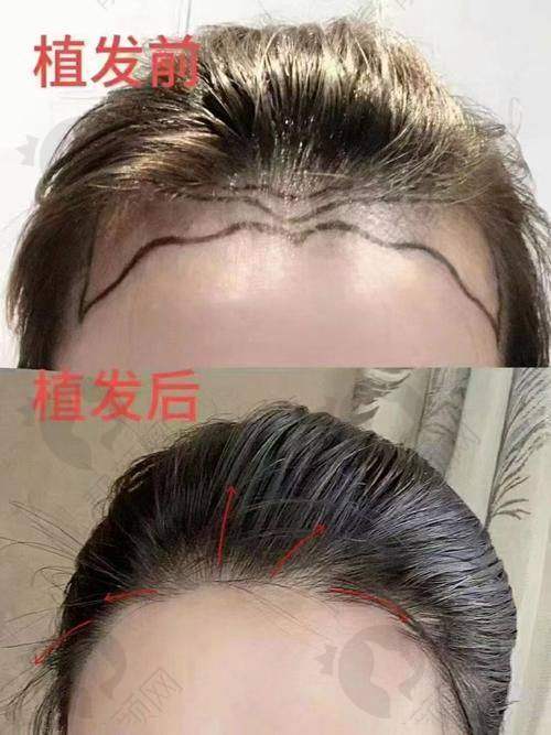 南京新生医院植发怎么样？医院基本情况大揭秘