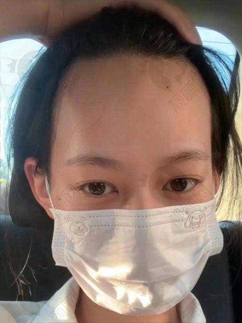 南京新生医院植发怎么样？实力医生团队保驾护航