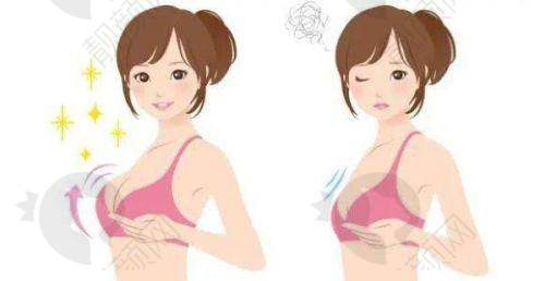 广州韩妃整形美容医院刘志刚院长：假体隆胸技术优势