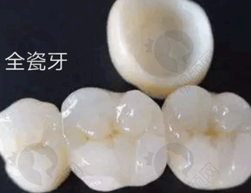 南昌摩尔口腔医院爱尔创全瓷牙牙冠医院优势总结