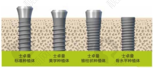 成都贝臣口腔医院技术强在哪？智能化设备与精细化服务