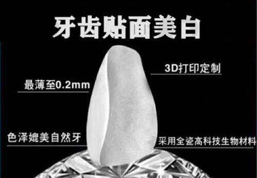 兰州海涛口腔透明价格,消费不踩坑